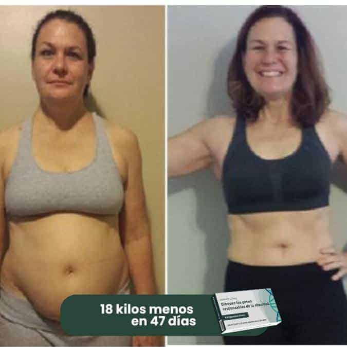 Prima e dopo la perdita di peso di 18 kg in 47 giorni.