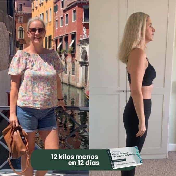 Prima e dopo l'uso di Nopalizumab per perdita di peso.