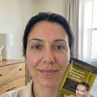 Donna con maschera facciale naturale per acne e cicatrici.